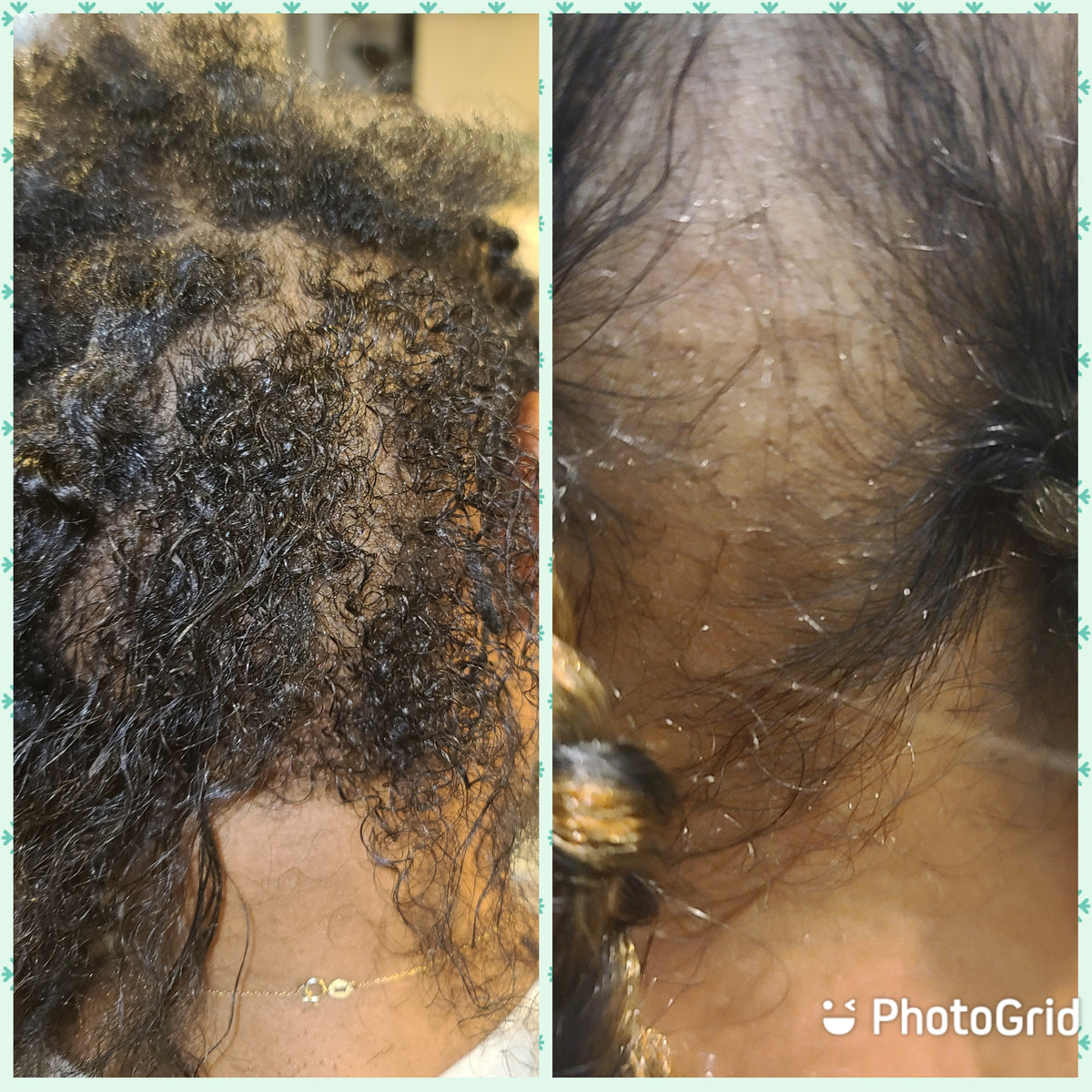 GROpunzel ® Hair Growth Oil